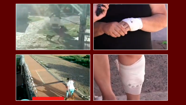 Vecinas piden intervención ante reiterados ataques de un perro en Luque