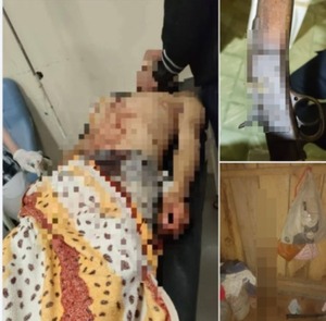 San Juan Nepomuceno: Hombre muere de un escopetazo en medio de una discusión entre hermanos