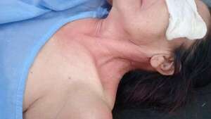 Atacan a una mujer con presunto gas pimienta en Mariano Roque Alonso - Policiales - ABC Color
