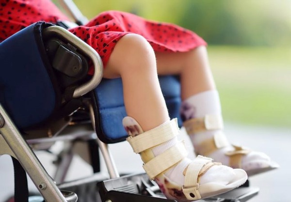 Familiares de personas con Atrofia Muscular destacan trabajo de FONARESS para ayudar en tratamientos