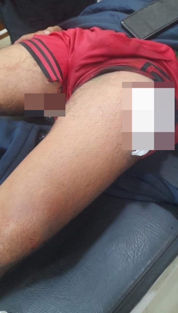 Ypané: atacaron a balazos a un joven en su propia casa