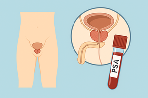 Próstata: lo que todo hombre debe saber para prevenir problemas » San Lorenzo PY