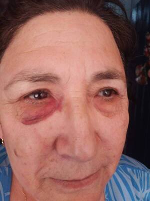 Hija agrede a su madre para echarla de la casa que ella misma construyó