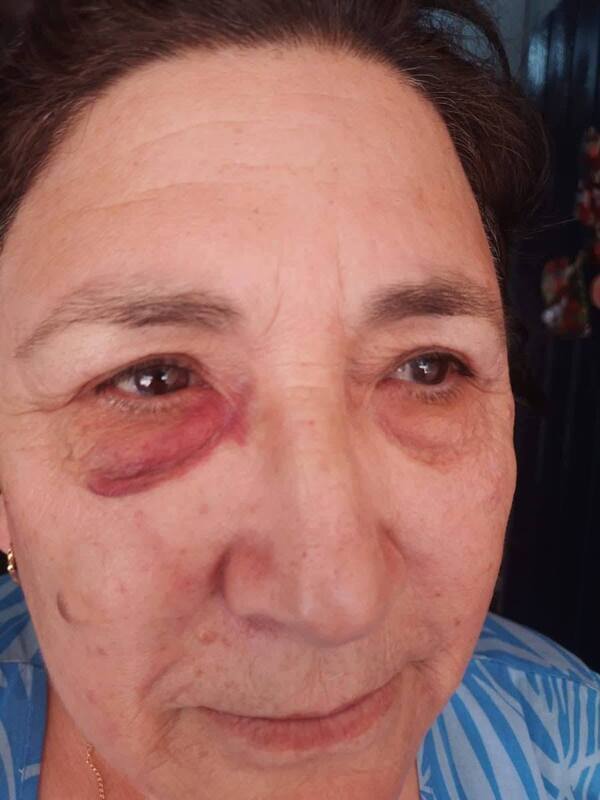 Hija agrede a su madre para echarla de la casa que ella misma construyó