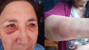 Trabajó 13 años en España y su hija le pegó y dejó en la calle