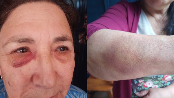 Trabajó 13 años en España y su hija le pegó y dejó en la calle