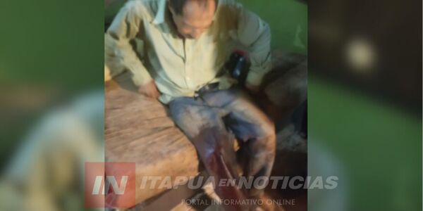 DISPARAN A UN HOMBRE PARA ROBARLE EN CAPITÁN MIRANDA