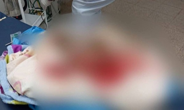 Imputan a la madre de la recién nacida hallada en una letrina en Caaguazú - OviedoPress