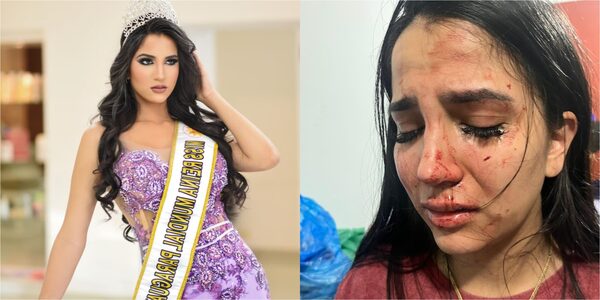 Popular / (GALERÍA) ¡Terrible! Miss denunció agresión y amenaza de muerte por parte de un ñato