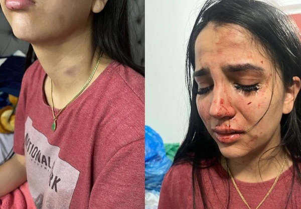 Reina de belleza denuncia violenta agresión y amenazas de muerte por parte de funcionario judicial - OviedoPress