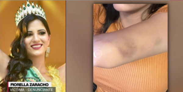 Modelo acusa a funcionario judicial por presunta agresión física y verbal