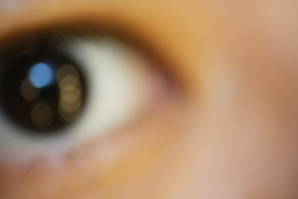 Visión borrosa súbita: lo que tus ojos podrían revelar sobre tu cerebro - Estilo de vida - ABC Color