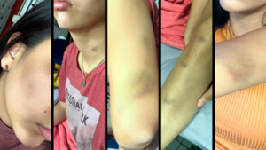 Modelo denuncia agresión física y violenta de funcionario judicial