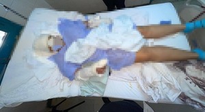 Brutal ataque con machete a una mujer en San Antonio