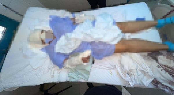 Brutal ataque con machete a una mujer en San Antonio