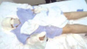 Fingió estar muerta para que el extraño no la asesinara