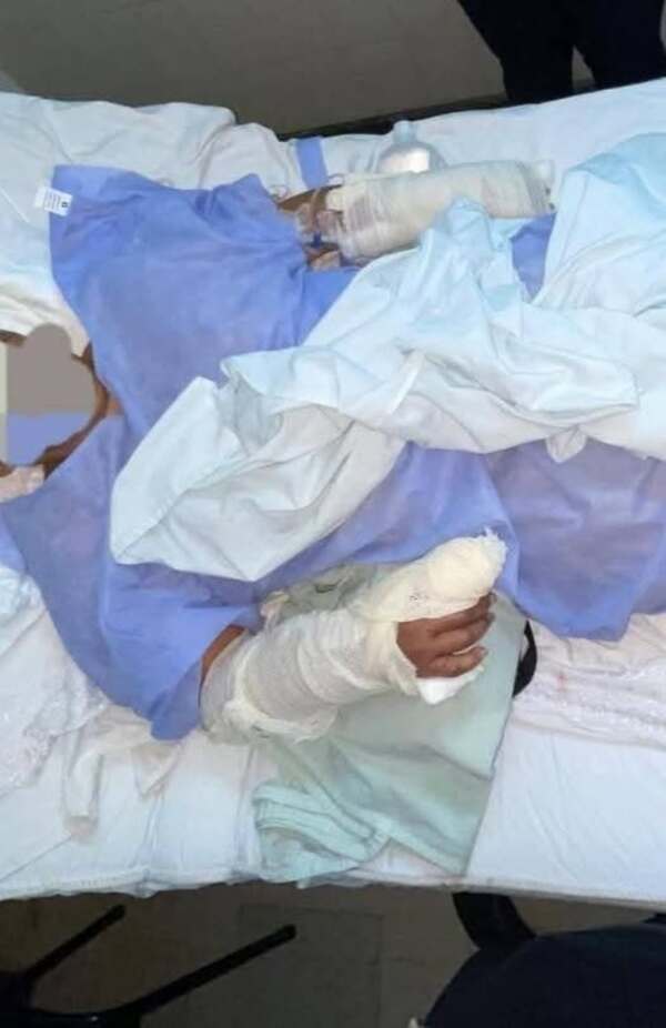 Mujer de 45 años sobrevive a brutal ataque con machete