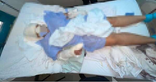 La Nación / Mujer sobrevive a brutal ataque haciéndose de la muerta