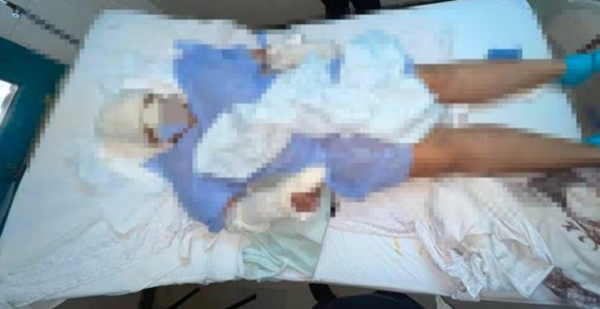 Mujer sobrevive a brutal ataque haciéndose de la muerta