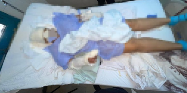 Mujer fingió estar muerta para sobrevivir a ataque a machetazos