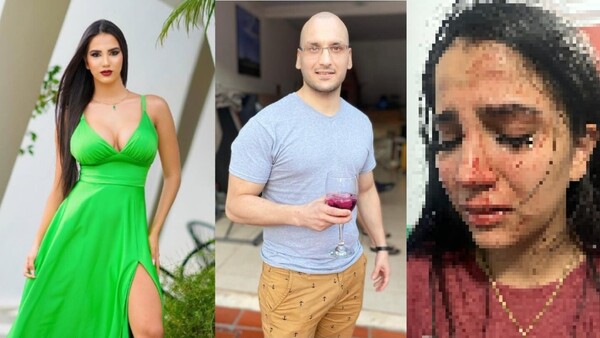 Modelo violentada dijo que su exnovio le sigue amenazando