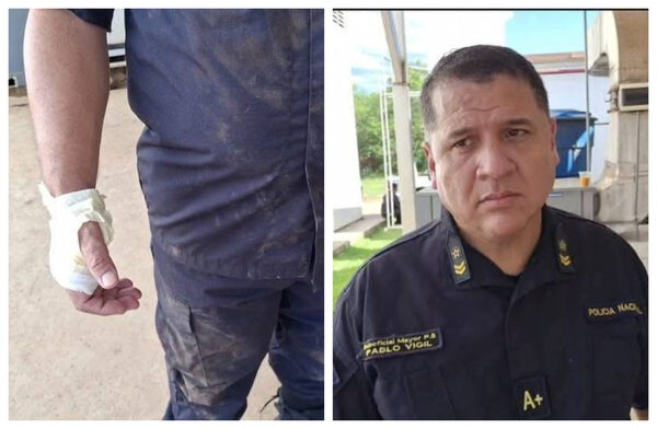 Popular / Durante persecución, poli y presunto mondaha quedaron heridos