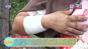 "No puedo moverme, casi me mató", dos perros mordieron a una mujer y a su hijo