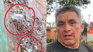 Rompió una jarra por la cara de su vecino: lío sería porque el señor tiene una esposa joven