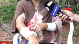 Mujer fue atacada por los mismos perros que mordieron a su hijo