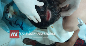 CON LA “PATA” DE UNA MESA LE ROMPIERON LA CABEZA AL ALUMNO DEL CREE