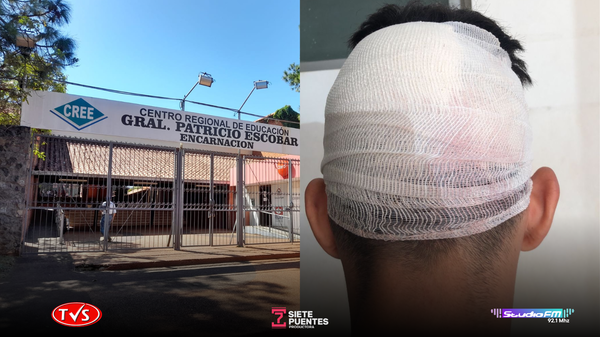 INCIDENTE EN EL CREE: ADOLESCENTE RESULTA HERIDO EN UNA PELEA ENTRE COMPAÑEROS - «TVS DIGITAL»