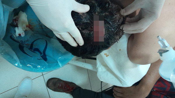 Popular / Pelea dentro de cole: Fiscalía no fue notificada