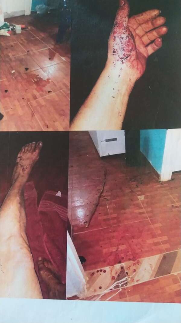 San Pedro: Víctima de feminicidio teme por su vida - Política - ABC Color