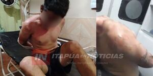  MENOR TERMINÓ “QUEMADO” DENTRO DE LA COMISARÍA DE CARLOS A. LÓPEZ