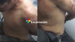 Adolescente resulta con quemaduras tras sup. incendiar colchón en calabozo de Carlos A. López