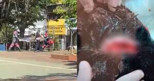 Diario HOY | Pelea entre alumnos acaba con un adolescente herido en Encarnación