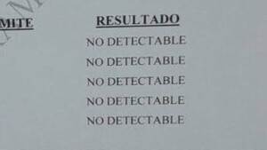 Le despidieron por un test de droga que nunca le mostraron