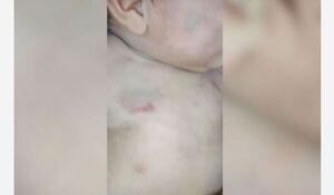 Bebé hospitalizado tras golpiza por parte de su padre en Minga Guazú