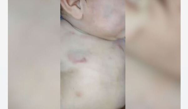 Bebé hospitalizado tras golpiza por parte de su padre en Minga Guazú