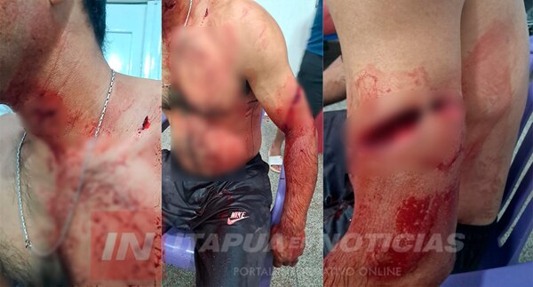 HERIDO DE GRAVEDAD TRAS PELEA POR CELOS EN SAN PEDRO DEL PARANÁ