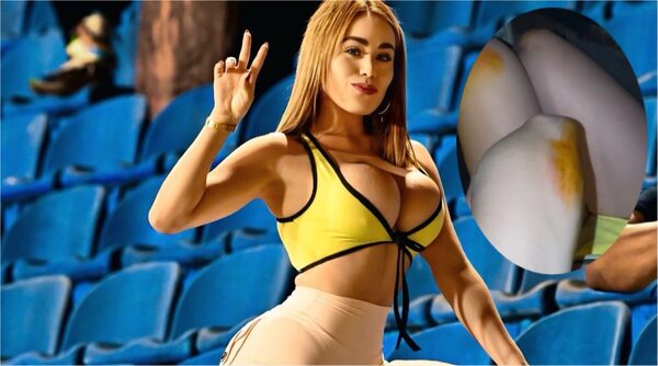 Popular / (VIDEO) ¿Qué le pasó? Maína de Guaraní quedó toda machucada luego del partido contra Libertad