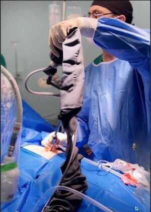 Popular / Encarnación ra'e fue la pionera de la cirugía sin huellas, no fue Asunción