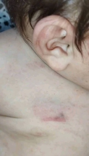 Investigan presunta agresión a un bebé por parte de su padre en Alto Paraná