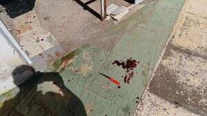 Mujer presuntamente ebria apuñaló a un policía en Villarrica tras un intento de suicidio - Policiales - ABC Color