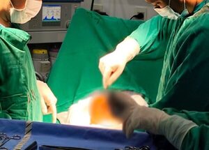 Popular / ¡Dionoguarde! Le sacaron un tumor de ocho kilos en Concepción