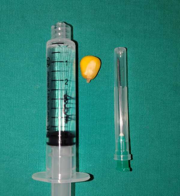 Popular / ¡Le salvaron!: Mitã'i de 4 años omokô grano de maíz