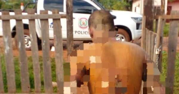 La Nación / A supuesto agresor de concejala le habrían prendido fuego otros adictos