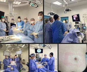 Cirugías sin cicatrices: el Hospital de Itapúa avanza en procedimientos de alta precisión