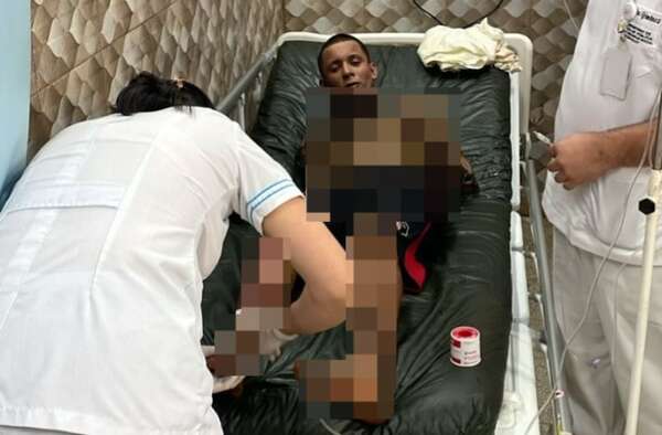 Joven que amenazó con arma de juguete a concejal resulta gravemente quemado tras pelea entre adictos - ABC en el Este - ABC Color