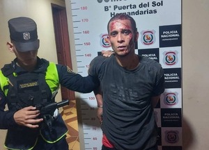 Hernandarias: Muere joven que intentó asaltar a concejala tras ser quemado - ADN Digital